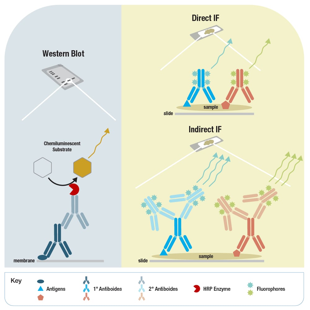 Antibody Essentials Part 5 Considerations for Antibody Selection